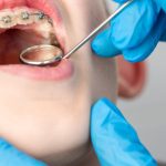 The Art of Dentofacial Orthopedics: Enhancing Facial Harmony and Function