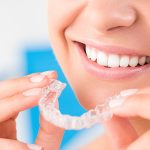 Alternatives to Braces: Are They Just as Effective?