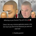 Scalp Micropigmentation: Restoring Confidence Through Innovation