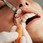 Choosing the Best Provider for Your Dental Implants