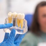 What to Expect from Endodontic Treatment for Tooth Pain Relief